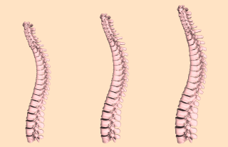 spine_thumbnail (1).png